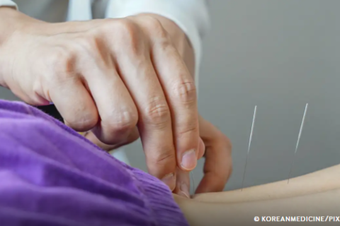 Brasil regulamenta exercício profissional da acupuntura.